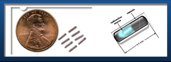 Seed Implant Picture & Diagram